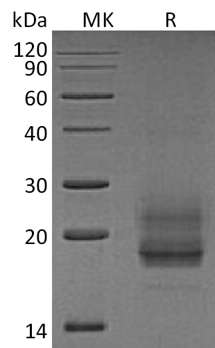 Human CD69 +SDS-PAGE.jpg